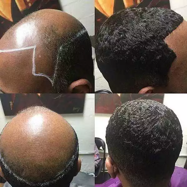 Check out this bald head transformation!